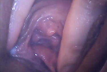在性生活和高潮期间，阴道内会发生什么？