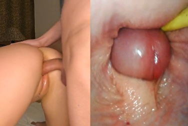 您见过从内部进行肛交吗？如果没有，请观看 👀 （镜头对准阴部）